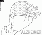 Dia Mundial del Alzheimer, 21 de setembre. La malaltia de Alzheimer és la més comuna malaltia neurodegenerativa